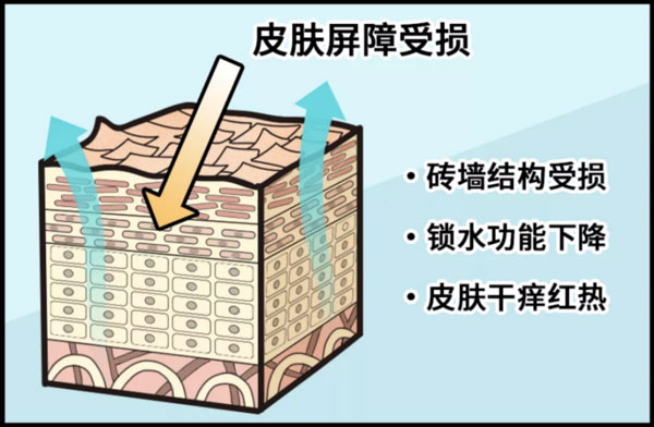 皮膚屏障受損后應(yīng)該如何修護(hù)？